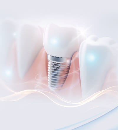 舒適美數位牙醫診所_微創植牙 微創植牙
