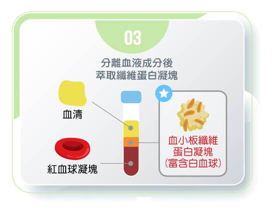 舒適美數位牙醫診所_PRF的製作流程3
