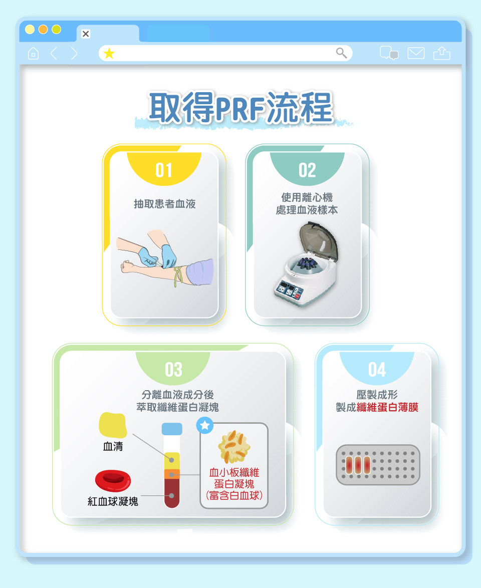舒適美數位牙醫診所_PRF的製作流程